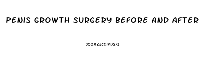 Penis Growth Surgery Before And After