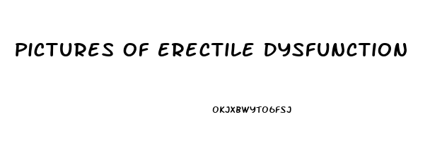 Pictures Of Erectile Dysfunction