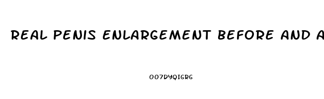 Real Penis Enlargement Before And After