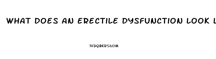 What Does An Erectile Dysfunction Look Like