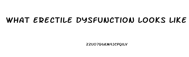 What Erectile Dysfunction Looks Like