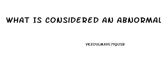 What Is Considered An Abnormal Sex Drive For Men