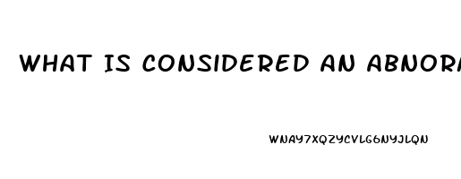 What Is Considered An Abnormal Sex Drive For Men