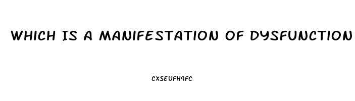 Which Is A Manifestation Of Dysfunction Of Cranial Nerve Iii