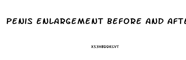 penis enlargement before and after pics