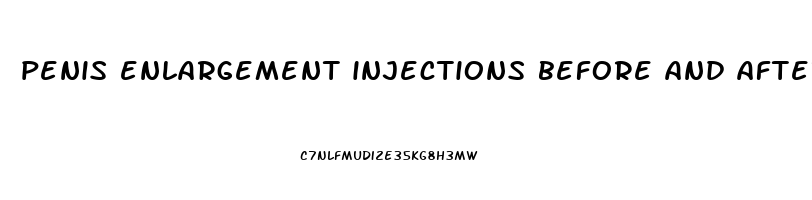 penis enlargement injections before and after