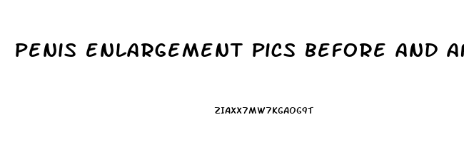 penis enlargement pics before and after