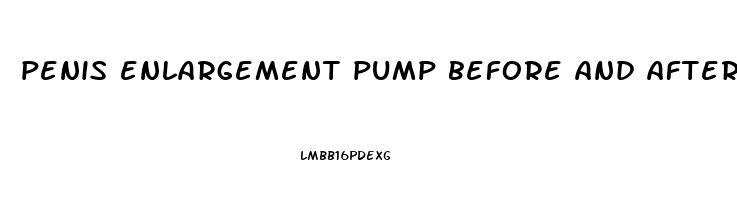 penis enlargement pump before and after