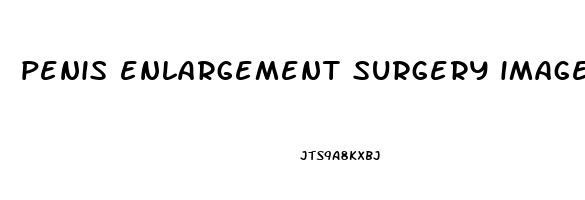 penis enlargement surgery images