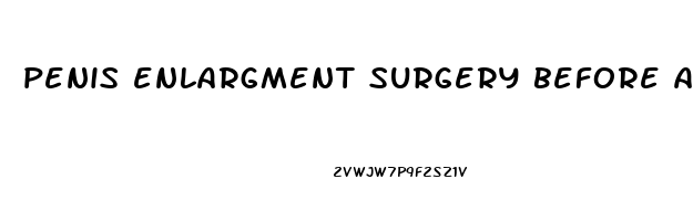 penis enlargment surgery before after