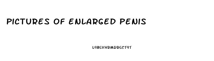 pictures of enlarged penis